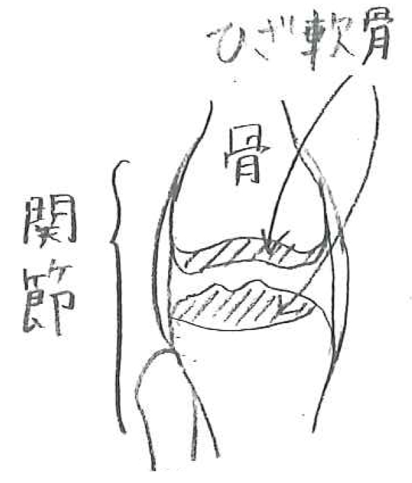 膝の痛み ・ 腰の痛み