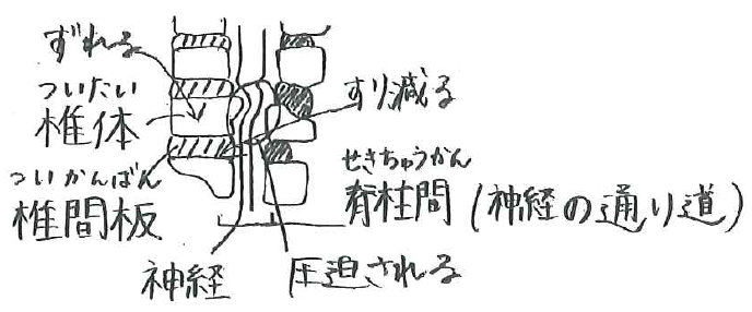 膝の痛み ・ 腰の痛み