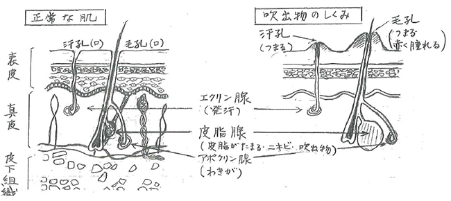 今フレッシャーの悩みはお肌です