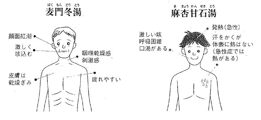 咳にご注意 咳 → 気管支炎 → 喘息